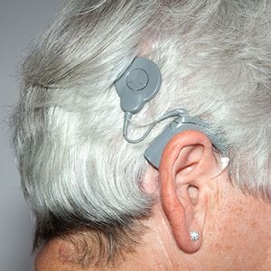 Frau mit Cochlea-Implantat-Versorgung