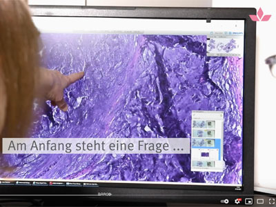 Digitale Pathologie im Marienhospital Stuttgart: Sie liefert schnelle und reproduzierbare Ergebnisse (Videobeitrag auf Youtube)