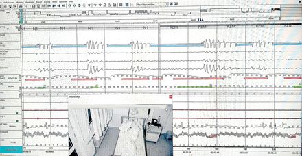 Bis zu 800 Seiten mit Messdaten fallen pro Patient und Nacht im Schlaflabor an. Gemessen werden u. a. Atmung, Gehirn- und Herzaktivität, Sauerstoffsättigung, Augen- und Körperbewegung