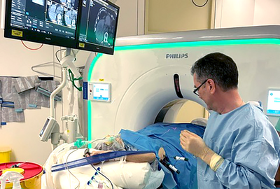 Mikrowellenablation eines Lebertumors Mikrowellenablation eines Lebertumors
