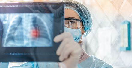 PET-CT: Mit diesem computertomografischen Verfahren l&auml;sst sich ein Lungenkarzinom im Fr&uuml;h&shy;stadium erkennen (Bild: shutterstock.com/Sushitsky Sergey)