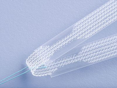 Das TVT-Band steht für „Tension-free Vaginal Tape“. Es besteht aus Kunststoff und wird zur Behandlung der Belastungs- oder Stressinkontinenz eingesetzt (Quelle: www.ami.at)