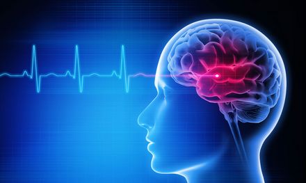 Ein Schlaganfall ist immer ein Notfall; jede Minute zählt (Bild: shutterstock.com/peterschreiber.media)
