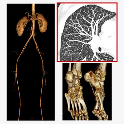 Darstellung von Organstrukturen in der Computertomografie