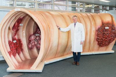 Prof. Schäffer am Darmmodell in der Eingangshalle des Marienhospital Stuttgarts