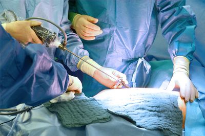 Brustkorbspiegelung im Marienhospital Stuttgart Brustkorbspiegelung im Marienhospital Stuttgart