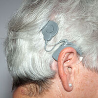 Frau mit Cochlea-Implantat-Versorgung Frau mit Cochlea-Implantat-Versorgung