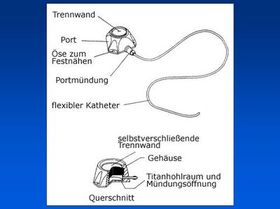 Venenportsystem (grafische Darstellung)