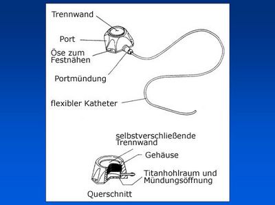 Venenportsystem (grafische Darstellung)