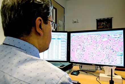 Die digitale Pathologie liefert schnelle und reproduzierbare Ergebnisse (Bildquelle: Philips)