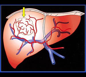 Blutgefäßsysteme der Leber (grafische Darstellung)
