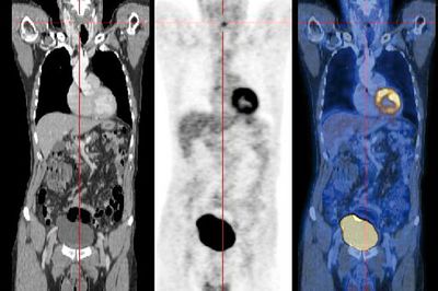 Sichtbarmachen von Gewebefunktionen und -strukturen im PET/CT