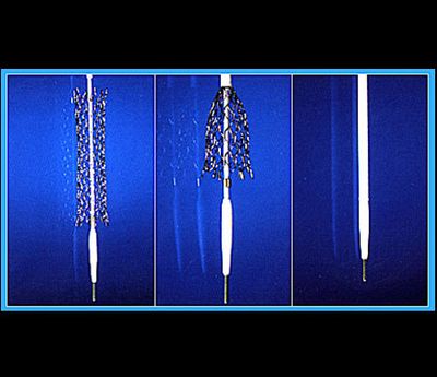 Innere Gefäßstützen (Stents) Innere Gefäßstützen (Stents)