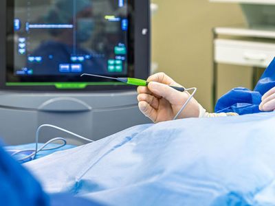 Neuromonitoring per Sonde erlaubt ein sicheres Operieren an der Schilddrüse Neuromonitoring per Sonde erlaubt ein sicheres Operieren an der Schilddrüse