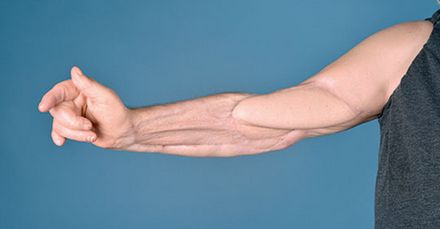 Man sieht, dass es sich um eine Rekonstruktion handelt, aber Arm und Hand sind wieder funktionsfähig